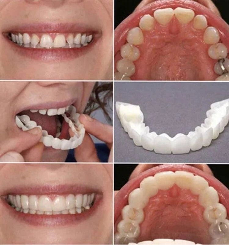 Facetas Odontológicas Removível - Kit Dental Superior e Inferior