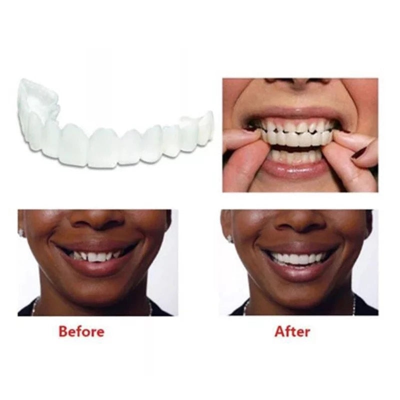 Facetas Odontológicas Removível - Kit Dental Superior e Inferior